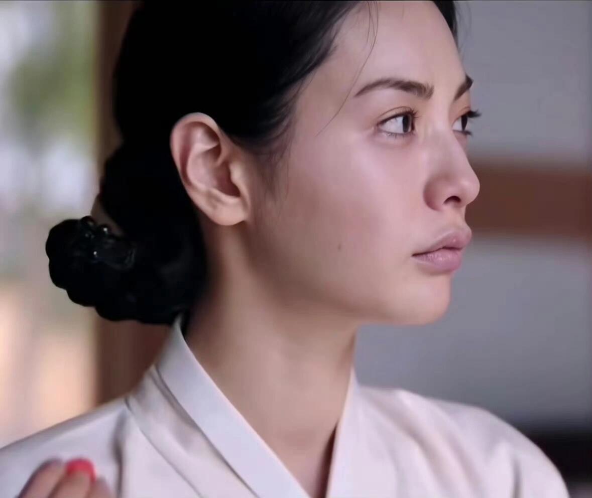 林珍娜 整商林珍娜之前的牙齿咬合就已经很完美了，现在动了之后反而显得鼻子高度不够
