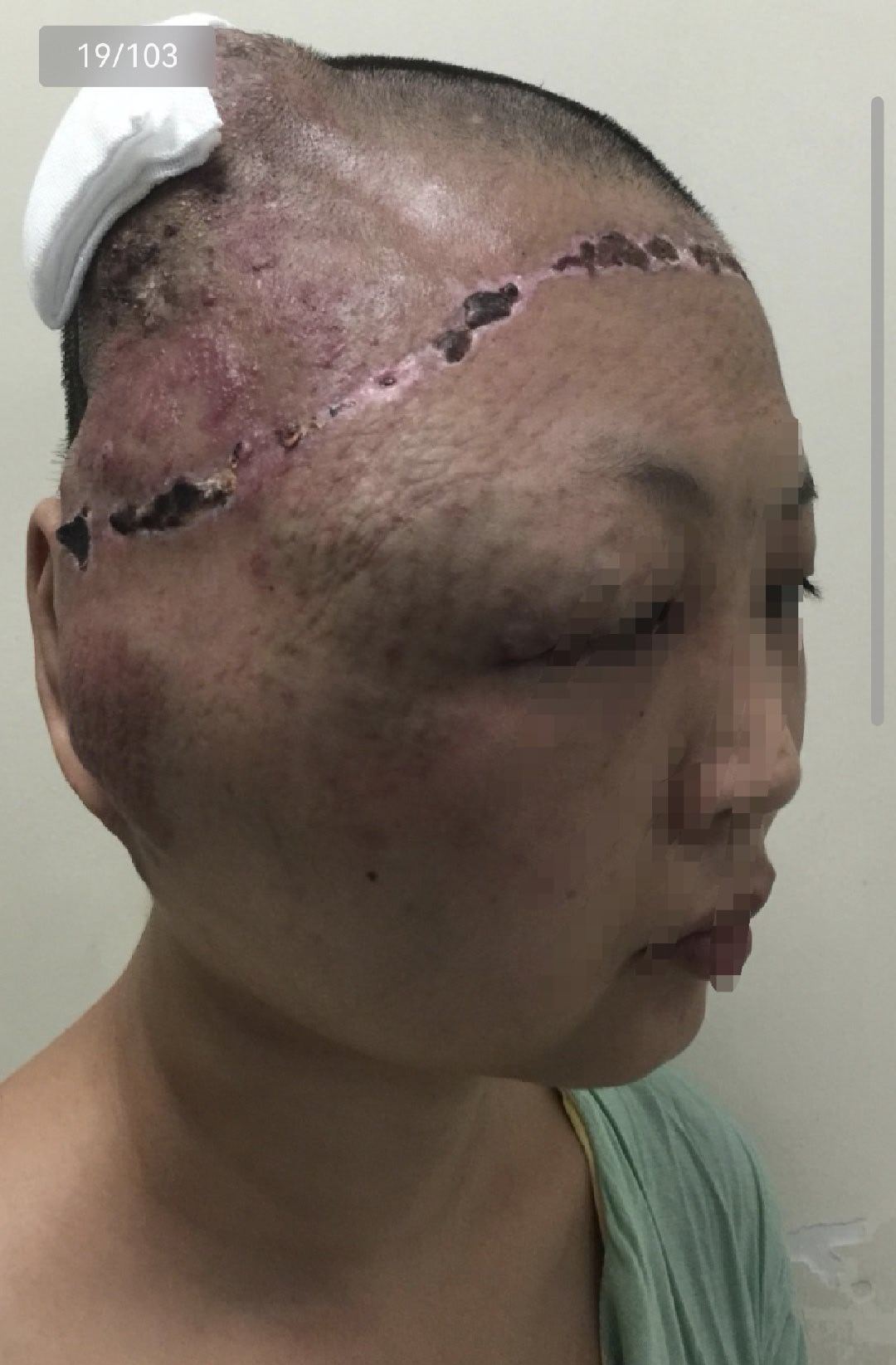 世界顶级整形美容大师，四川大学华西医院烧伤整形科主任，博士导师，四川大学华西厦门