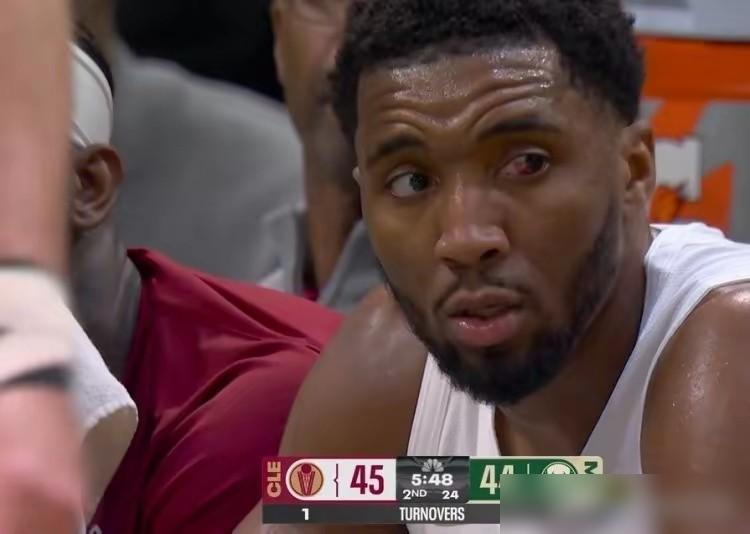 骑士核心米切尔这状态，球迷都捏把汗！
 
刚从腹股沟拉伤复出的他，3月赛场表现像