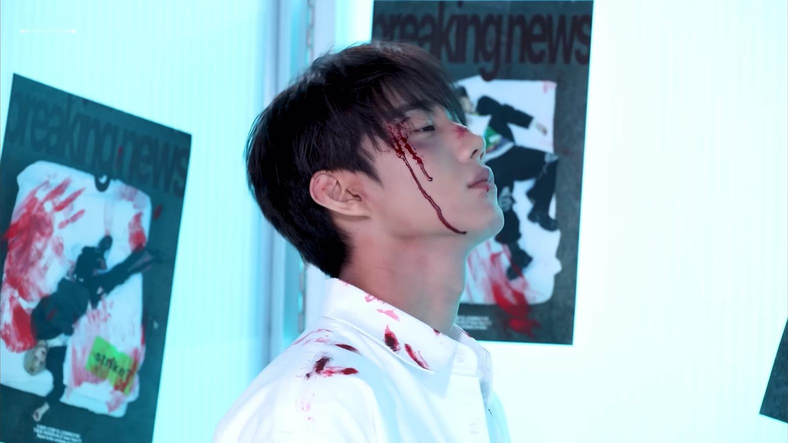 好惨好帅ㅜㅠㅠㅠㅠㅠㅠㅠㅠㅠ🩸🤕 