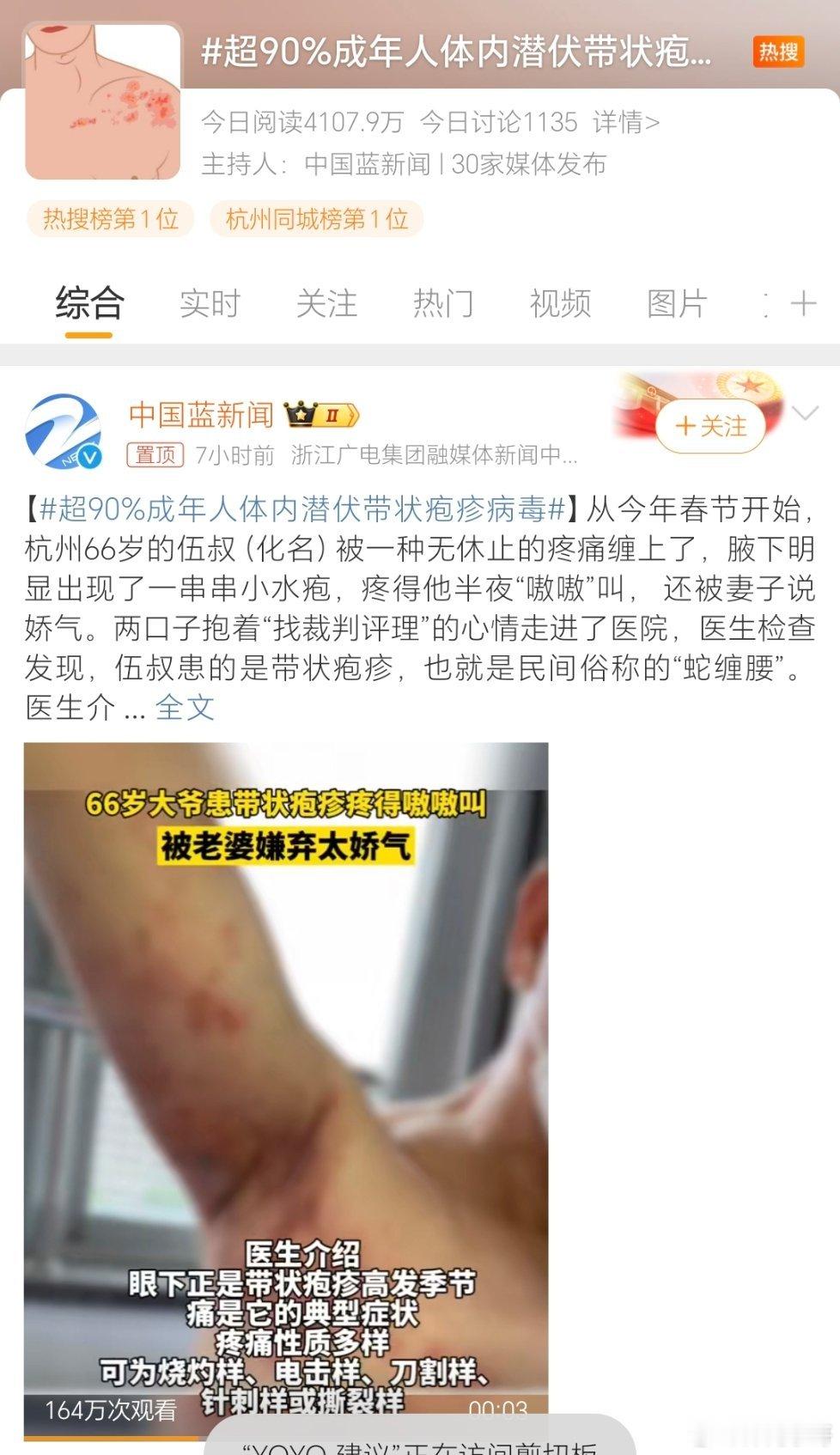 #超90%成年人体内潜伏带状疱疹病毒#可疼可疼了！ 50岁以上的人群发病率会升高