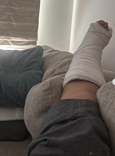 克里斯特尔斯的腿好严重！热点现场 ​​​