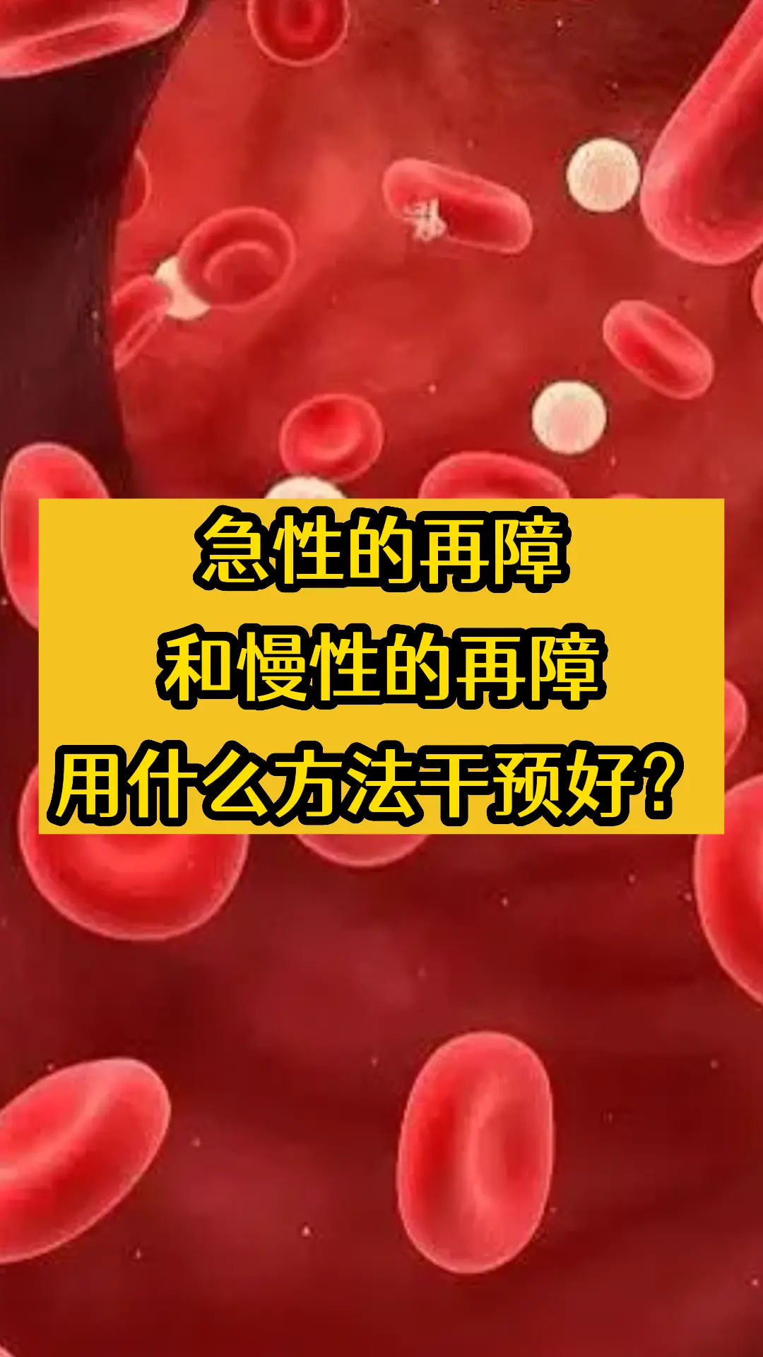 大家好我是韦云医生！有很多网友问得了再障该怎么办？其实再障我们分两种...