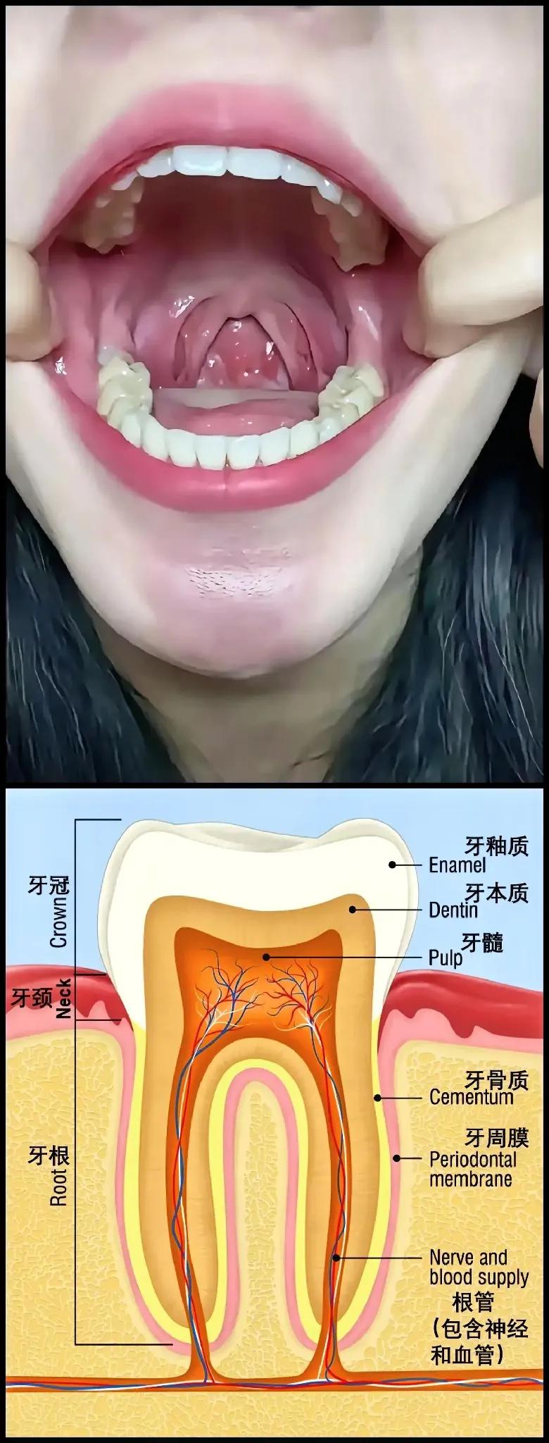 牙釉质！[白眼]
保护它，非常重要！

现在生活水平提高，寿命延长，人就会要求生