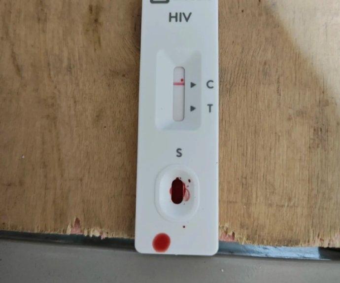 一直都想不明白，艾滋病这种病有什么高贵之处，要全社会为之保密？它是个绝症，也是个