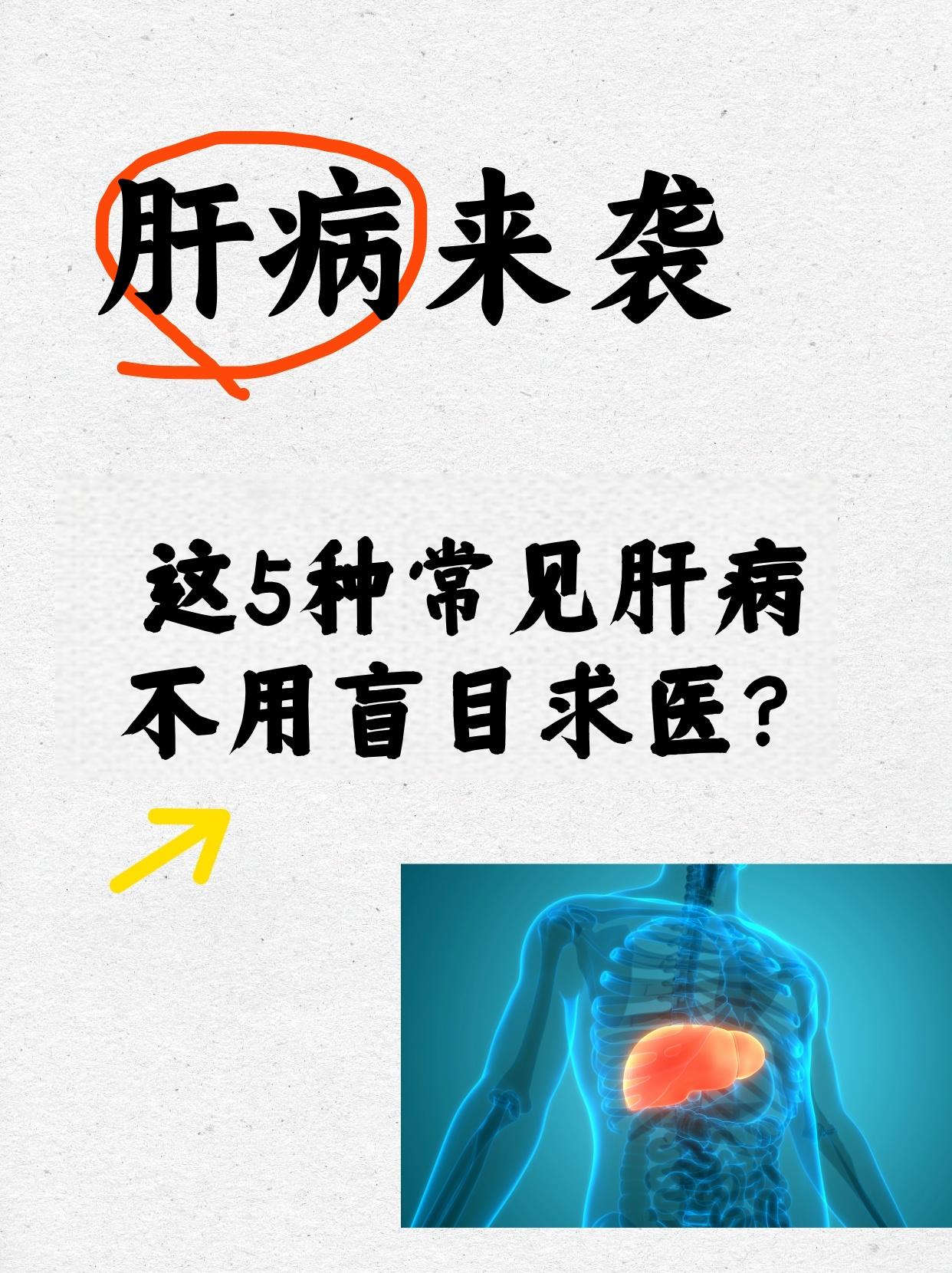 这5种常见肝病不用盲目求医？
1、乙肝： 达到治疗标准（如DNA阳性、转氨酶升高