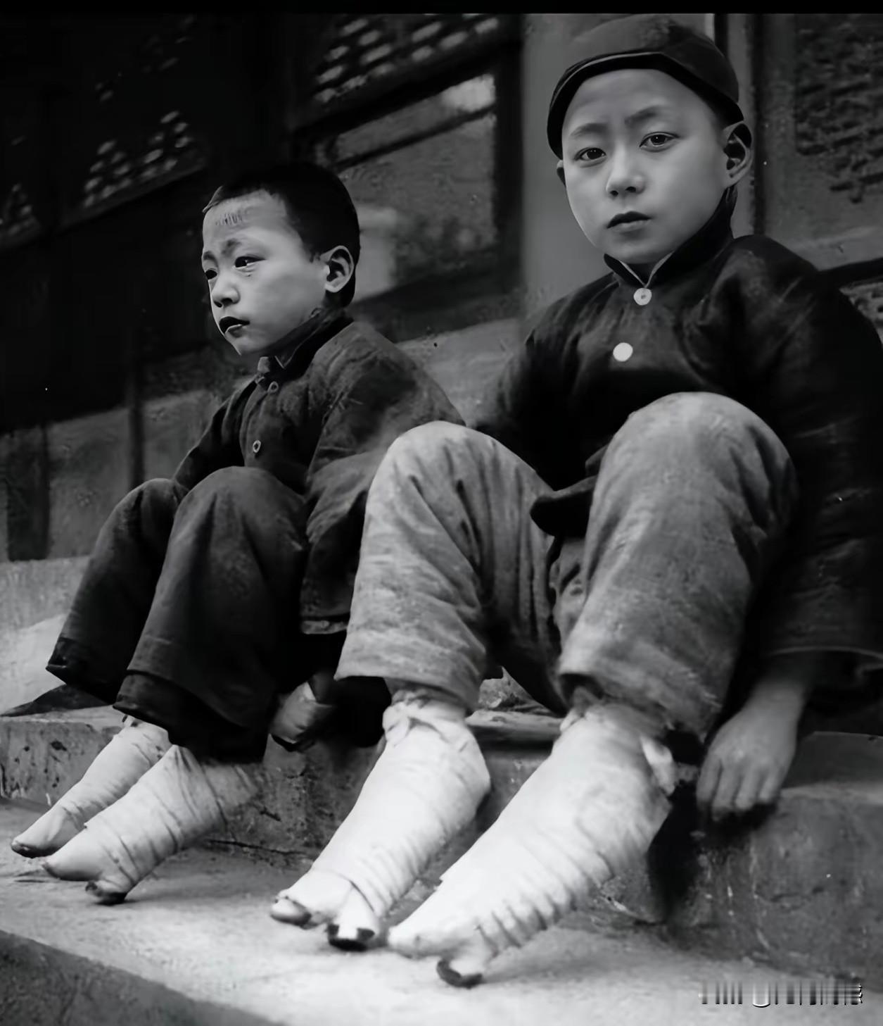 这两个男孩的脚，好像是缠着医用的绷带，给人的感觉好像是受伤了，但是如果细看的话，