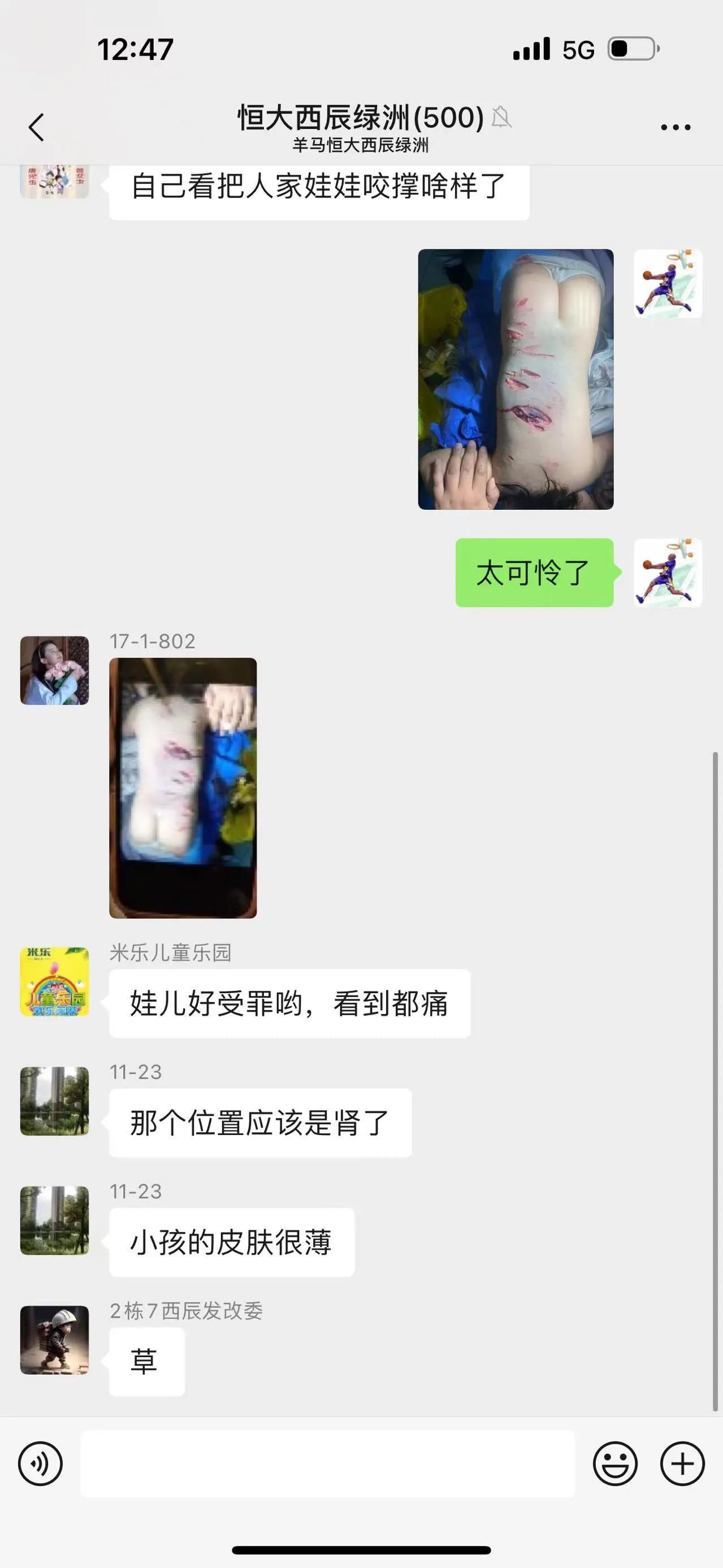 今天，崇州那边一个小区，两岁孩子被大型犬咬了，看着都心疼，不知道那些爱狗人士看到