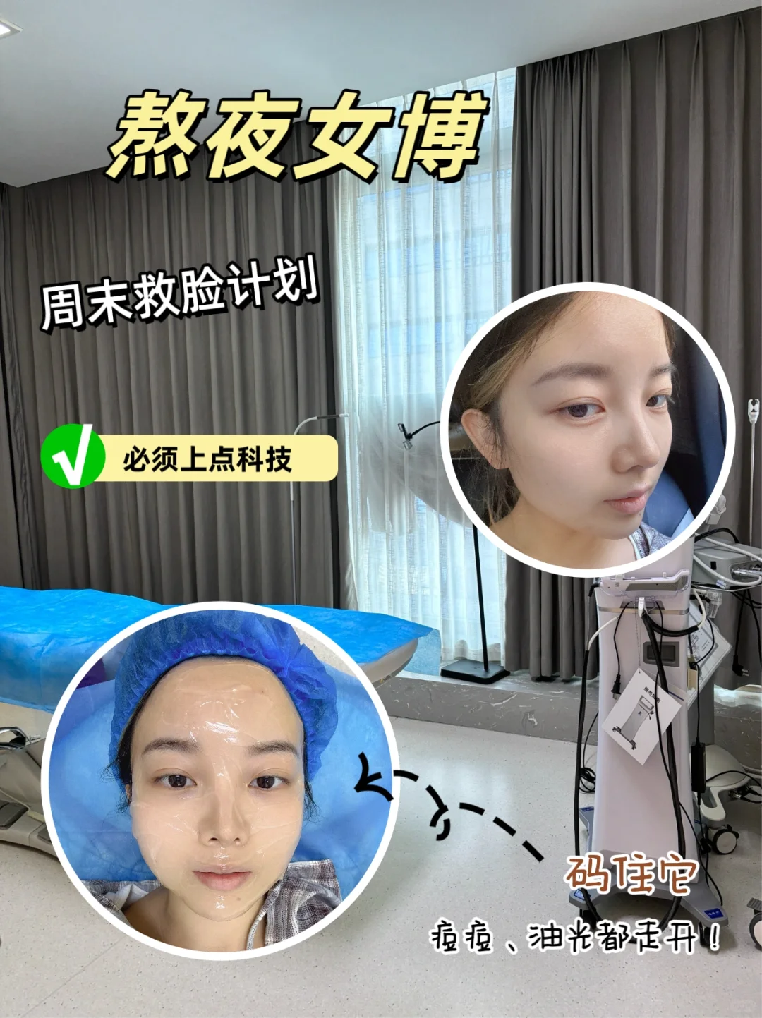 医学博士真实反馈丨光子嫩肤有用吗