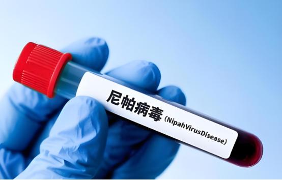 终于能松口气了？
武汉病毒研究所宣布找到有效药，高致死尼帕病毒迎克星！

中科院