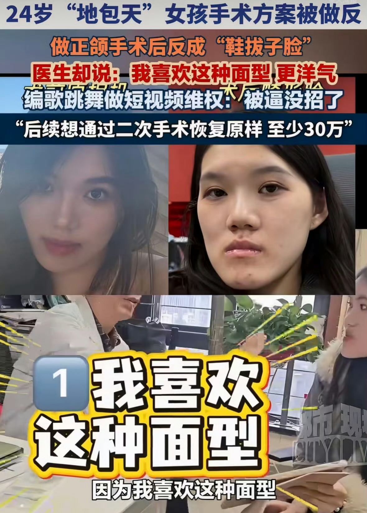 卫健委介入24岁女孩正颌手术被做反  要的是后移2毫米，却被往前推了13毫米？前