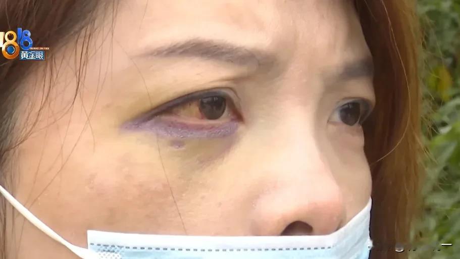 傅女士的美容“遭遇”：十万多换来的竟是这般“模样”
 
傅女士的美容经历可谓是一