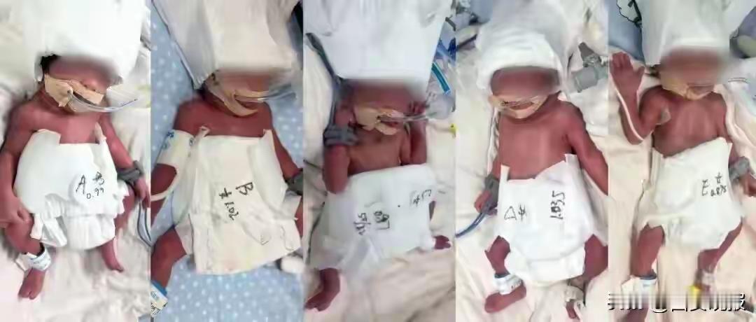 凌晨三点，武汉某医院灯火通明，一位来自新疆的24岁妈妈迎来了人生中最惊心动魄的时