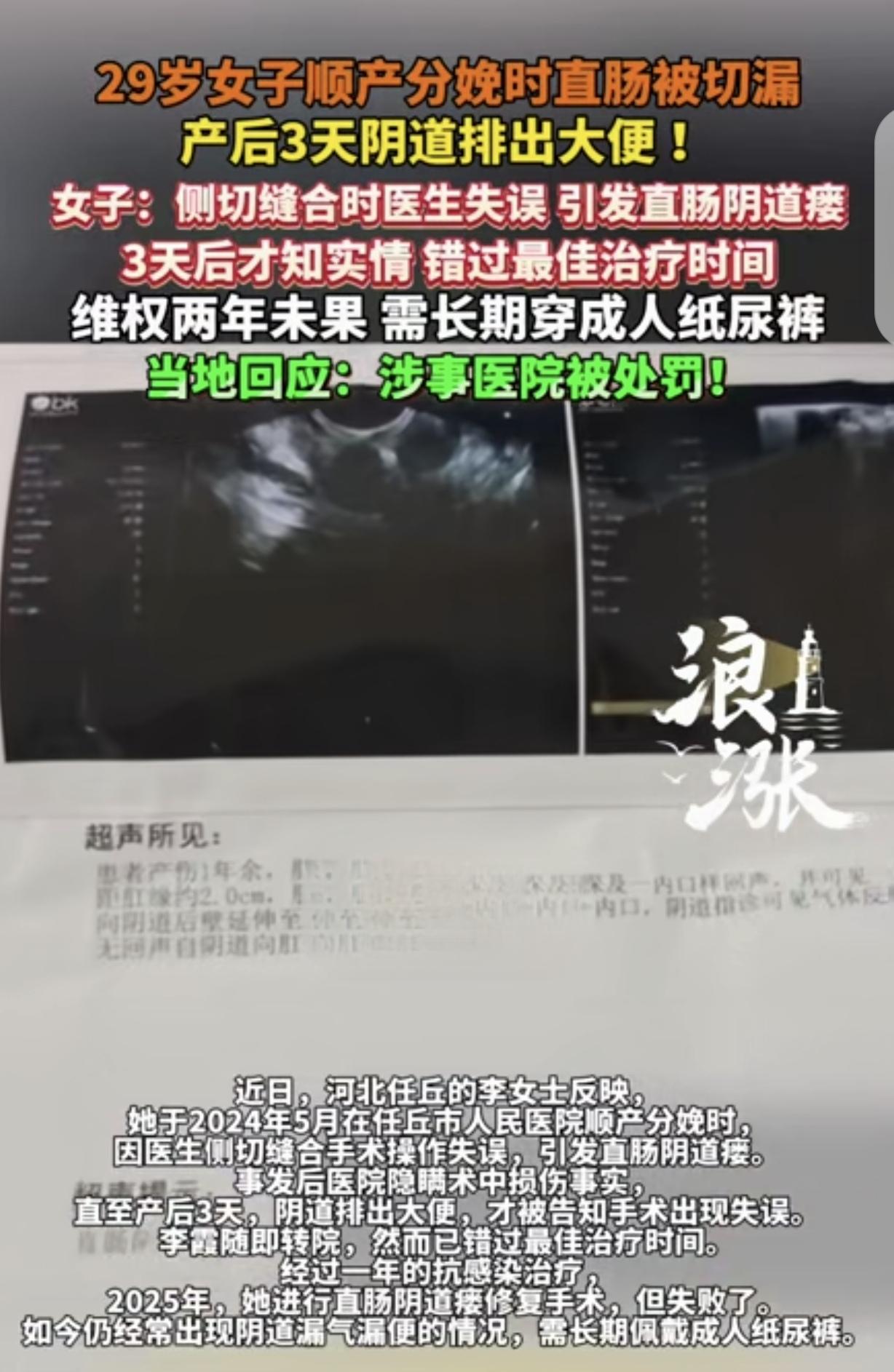 河北任丘，一29岁女子顺产生娃，医生给她侧切缝合时，一个失误，导致她直肠被切瘘，