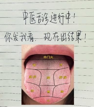 你的舌象是这样吗？今天有空，全网免费分析舌象！

胃口差，白天没精神，晚上睡不好