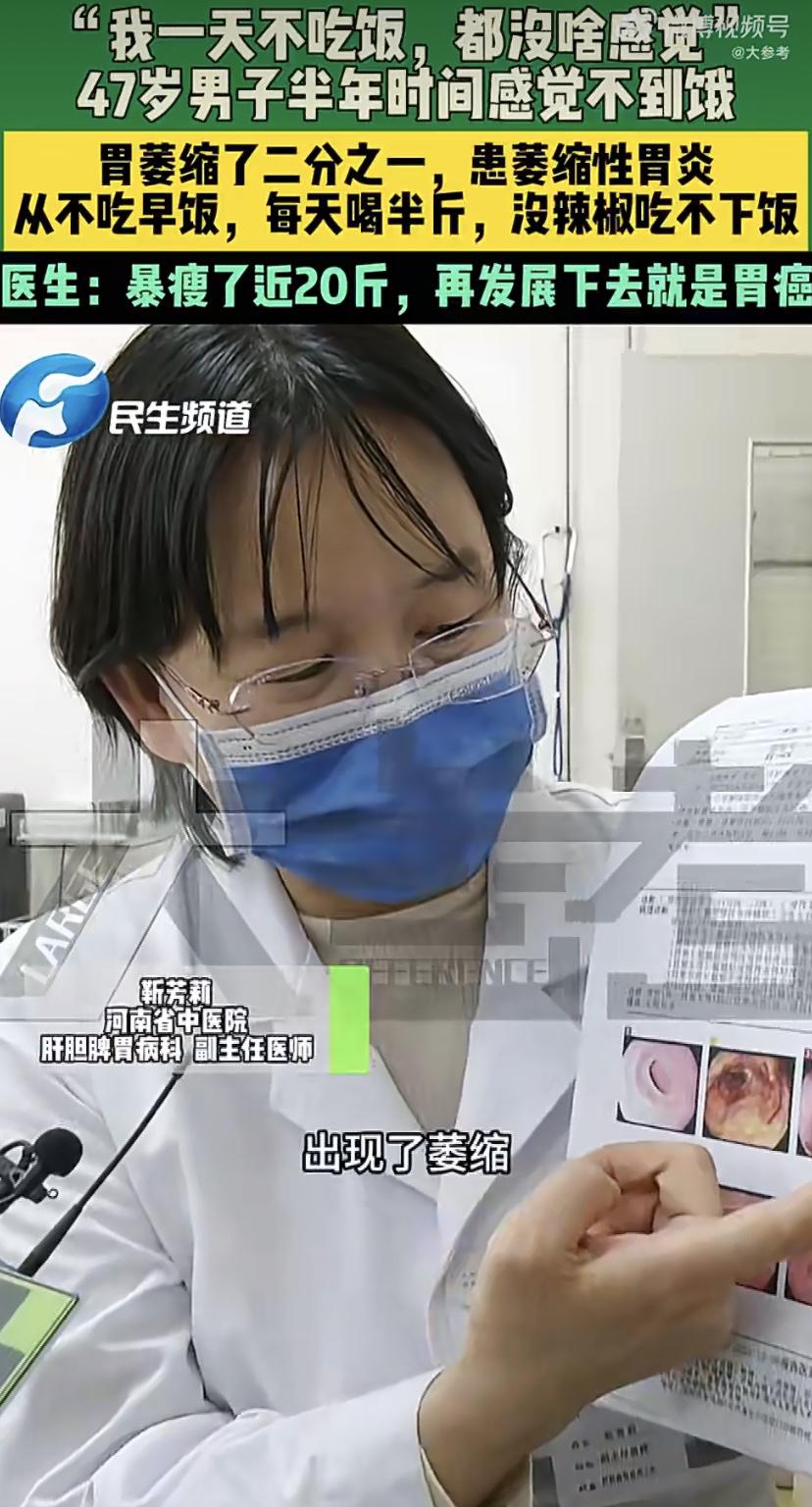 [警惕"不饿"的警报]河南一位中年男士，近半年都没什么饥饿感，一查竟是胃萎缩了一
