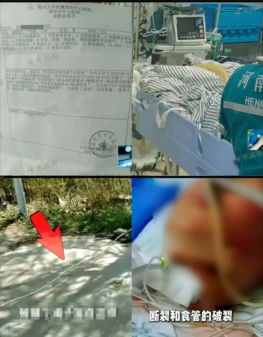 62岁老人私拉绳索打玉米，13岁男孩遭横祸喉管断裂谁能想到，一条为了一己私利私拉