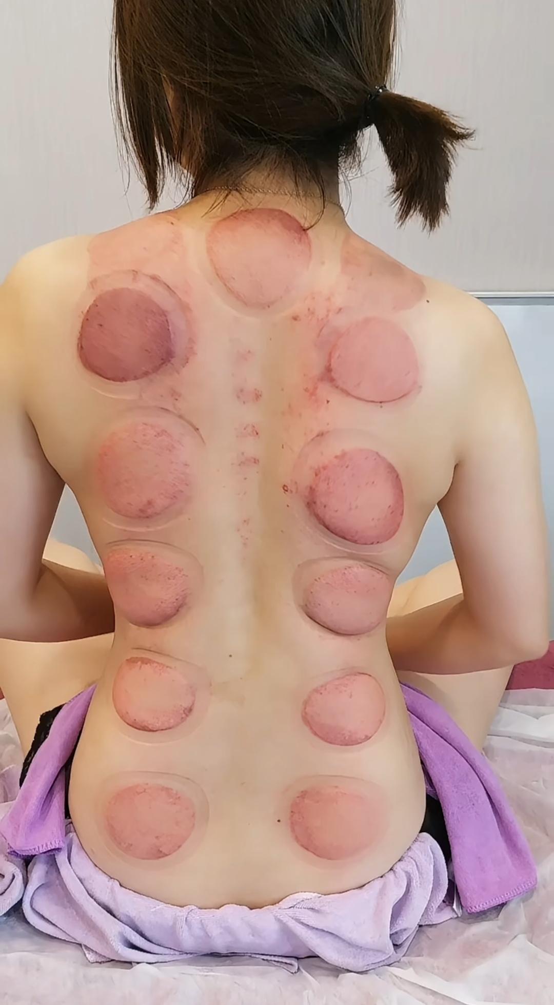 健康知识科普 手部穴位 手指操作用大 手部穴位按摩 拔罐的背