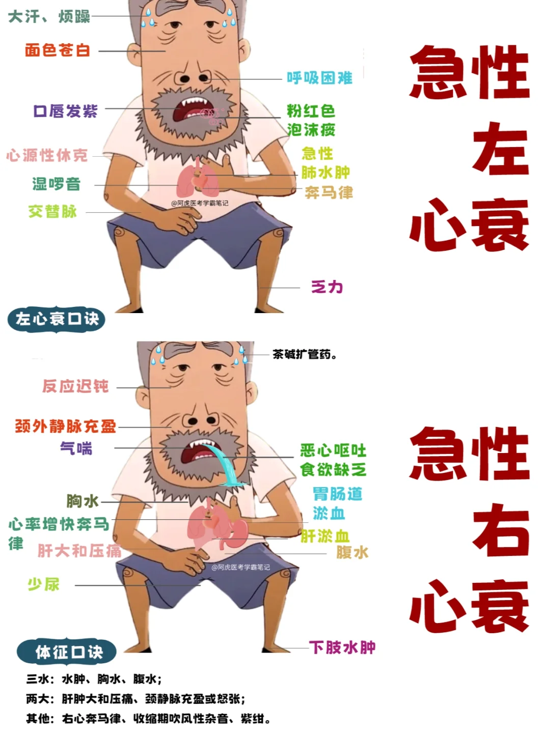 阿虎医考学霸笔记：急性左心衰VS急性右心衰