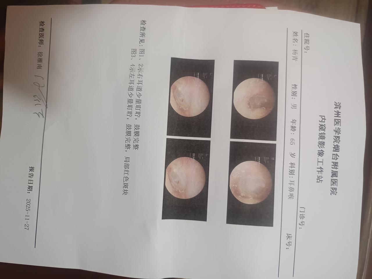 很遗憾，去医院用先进医疗器械一顿检查，没有查出病因。
耳鸣至今大概20天，尤其走