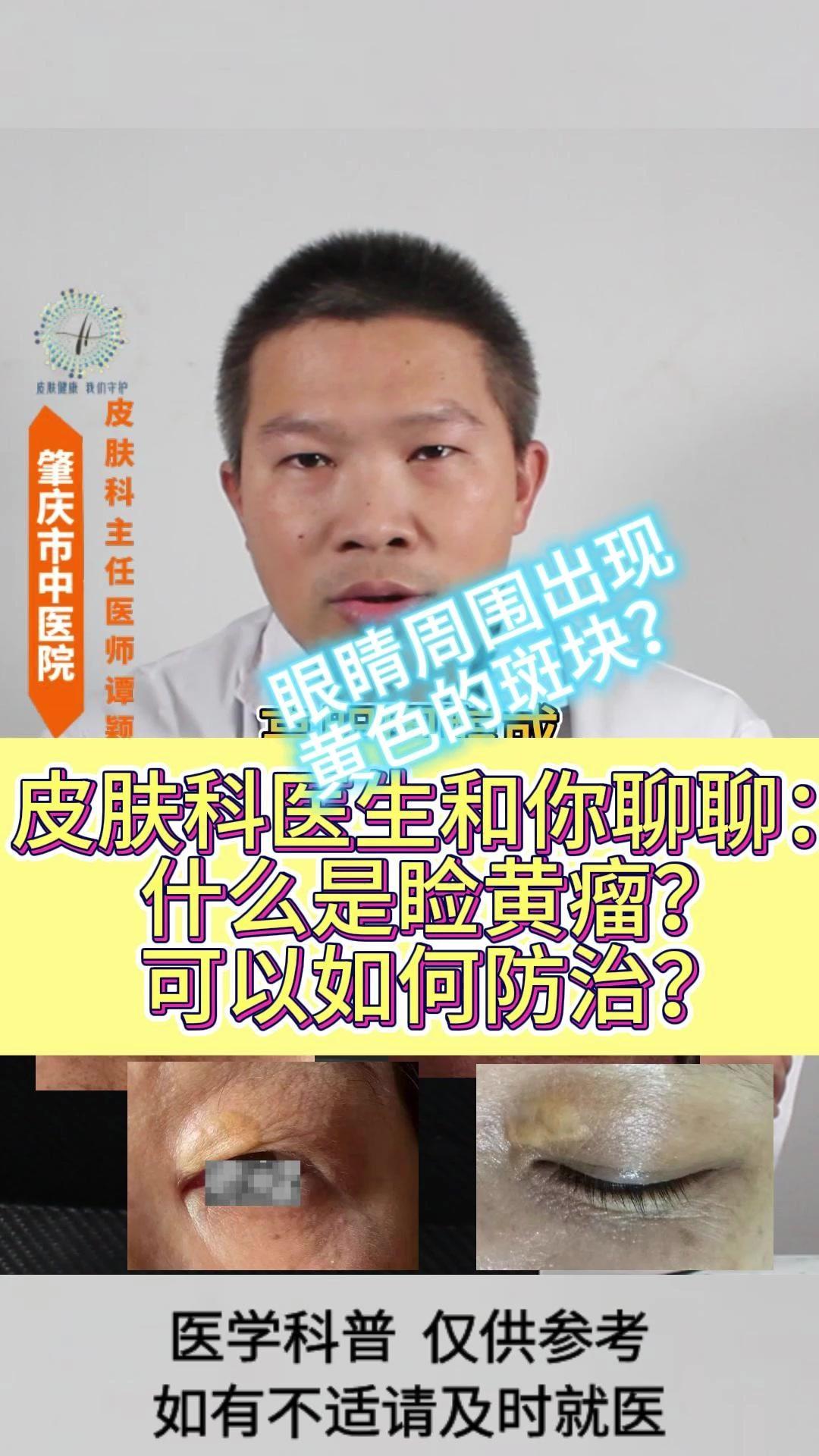 💡什么是睑黄瘤？
家人或者周围的朋友在眼睛周围可能会出现一些黄色的皮疹，这个有