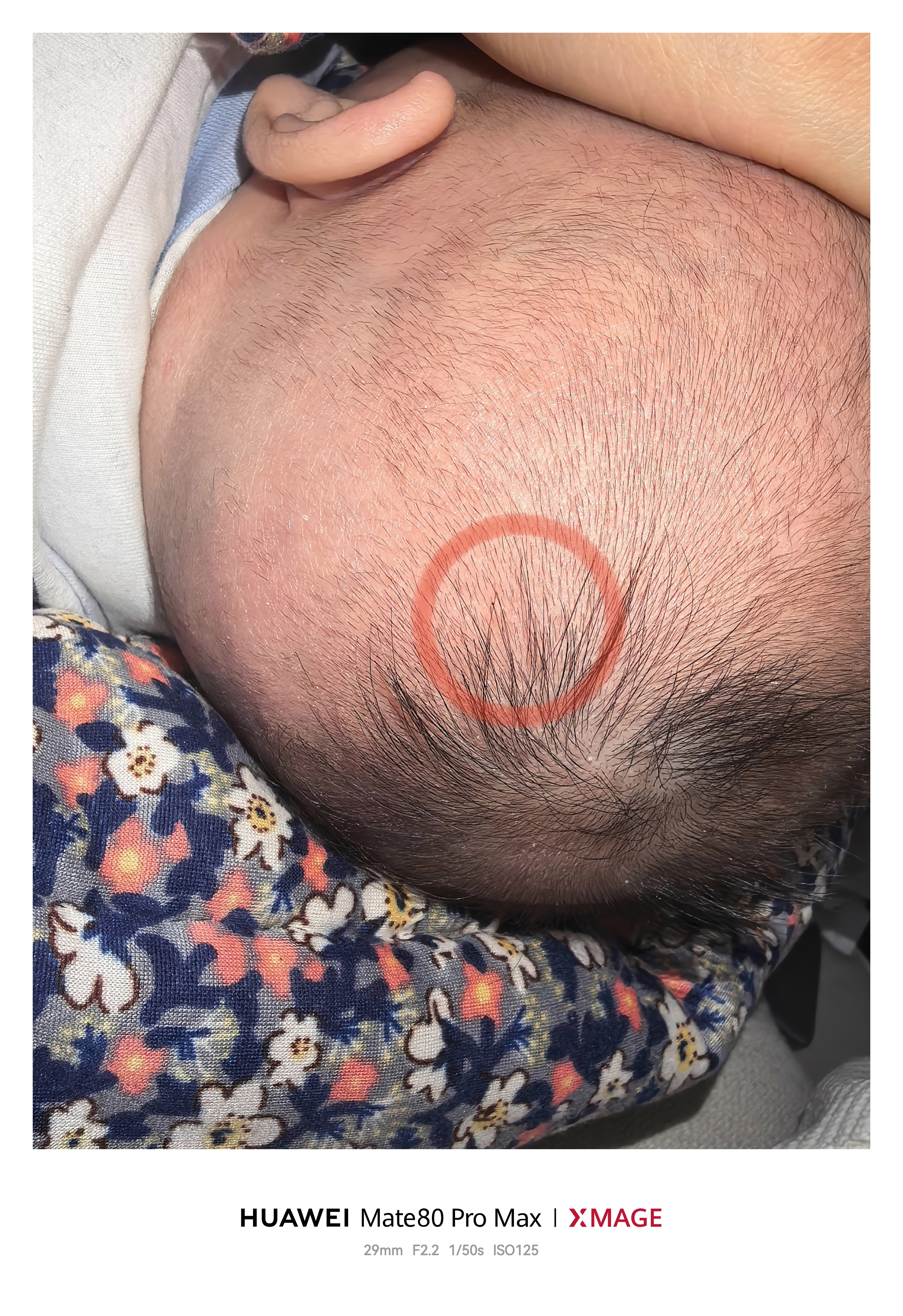 今天凌晨的时候，我抱着儿子准备上床睡觉，因为床比较高，所以是跪着上去的然后可能是