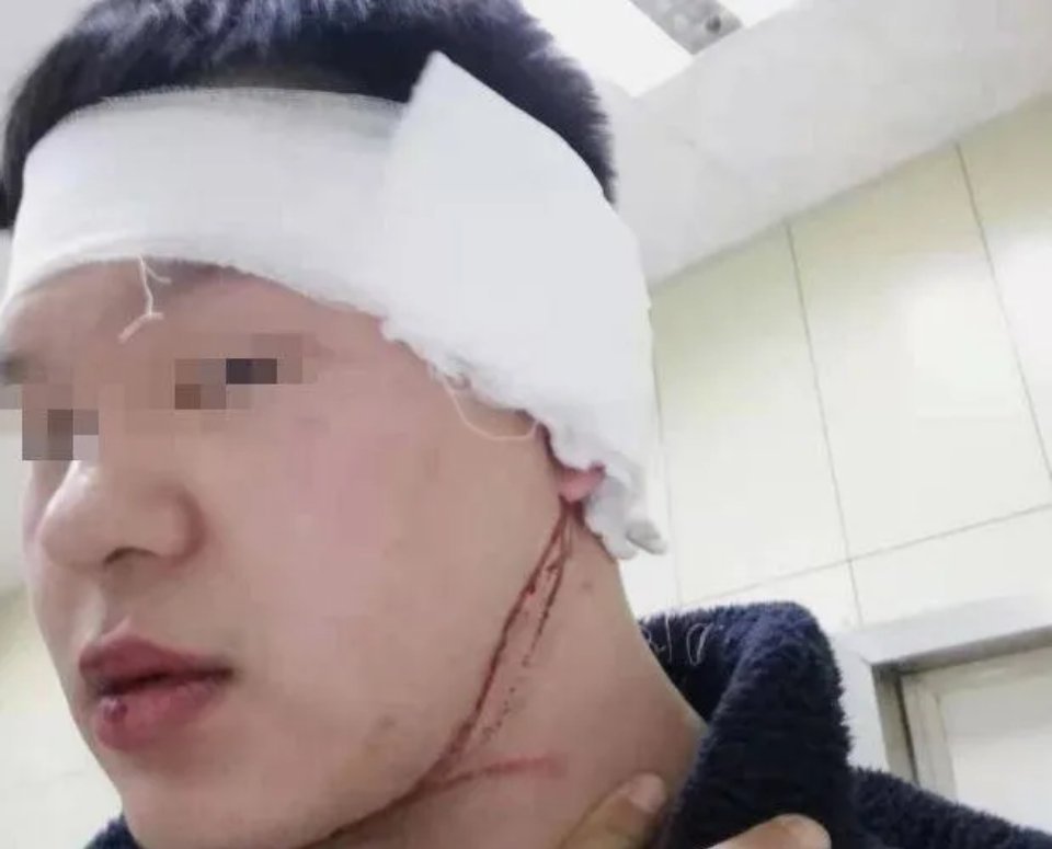 黑龙江，男子正在家看电视，楼上突然传来噪音，他敲墙提醒，不料，邻居下楼把他打了，