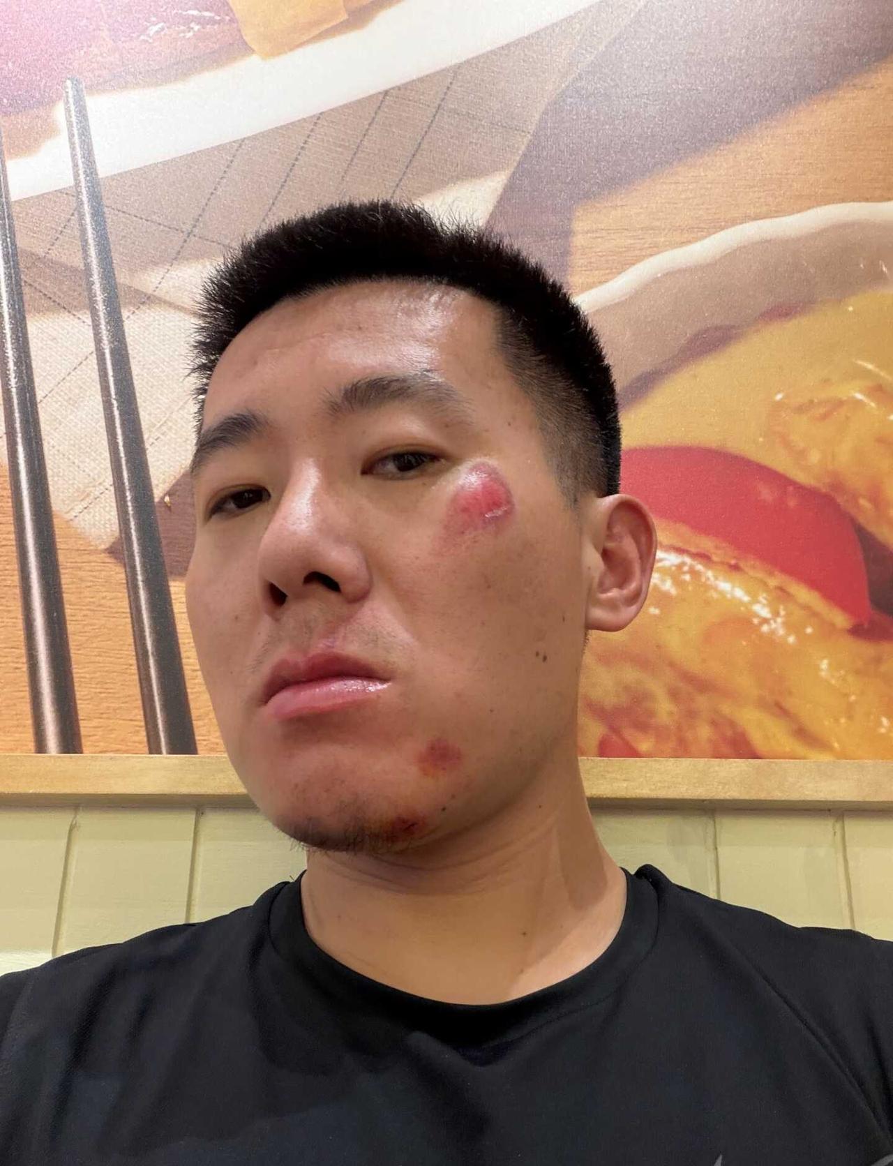 要乖一点了
受伤 喝酒日常 喝酒 摔跤 上海 毁容 再忍忍就过去了