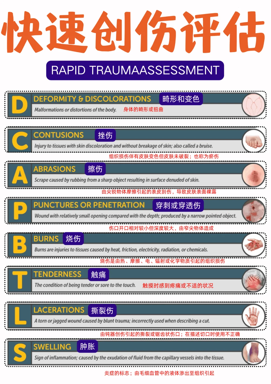 备考RN/快速创伤评估！！学！！单词