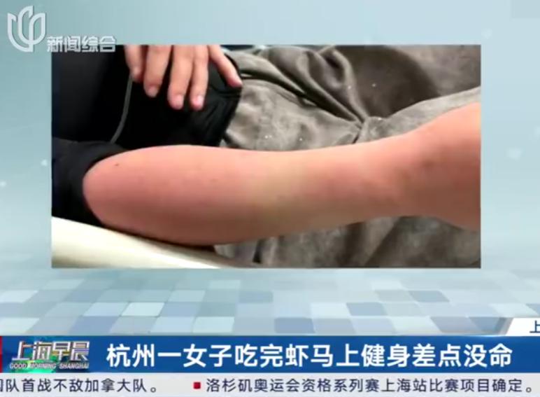 “差点窒息在自己手里！”7月9日报道，浙江杭州，潘女士午餐吃了虾，随后去健身房锻