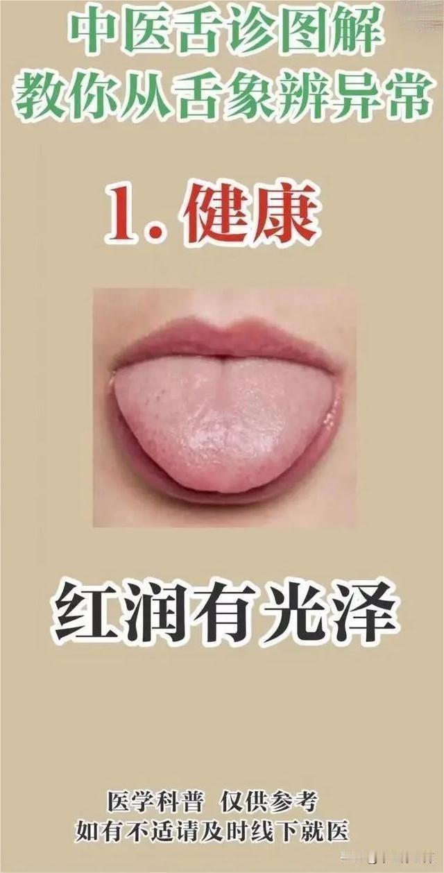 中医教你从舌象辨异常#健康##舌象分析#