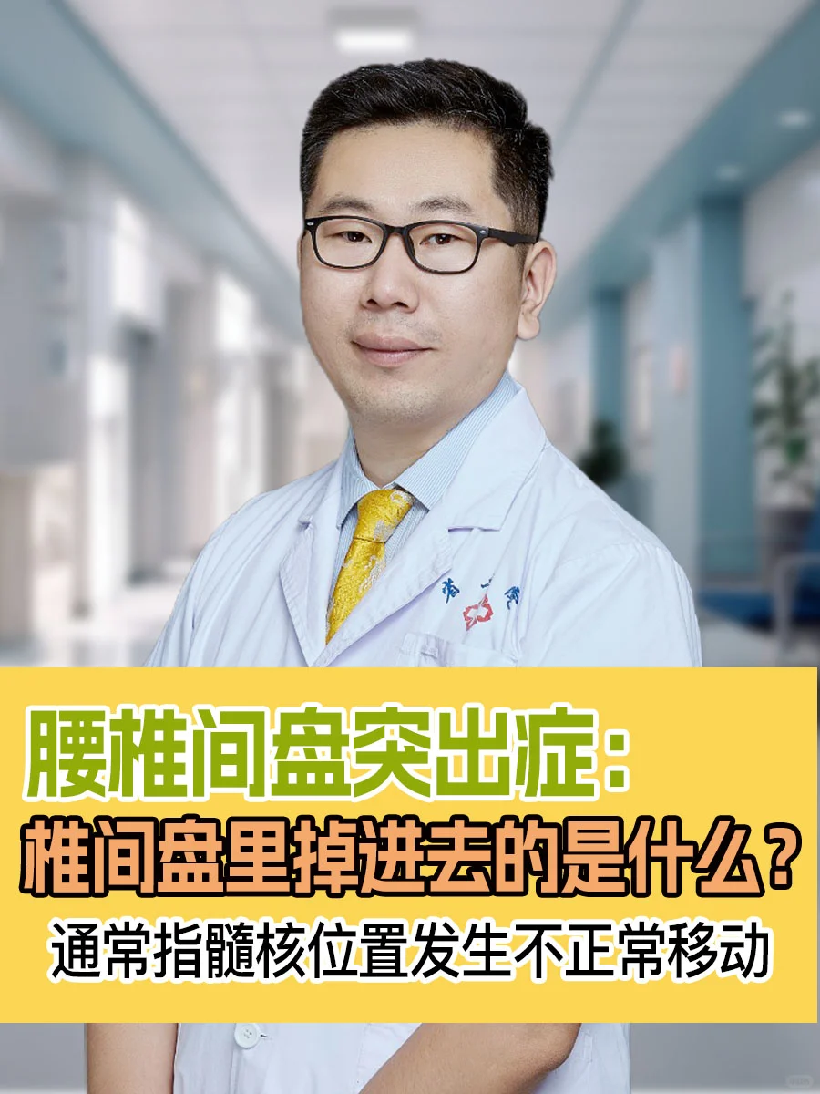 腰椎间盘突出,椎间盘里有个东西掉进去了