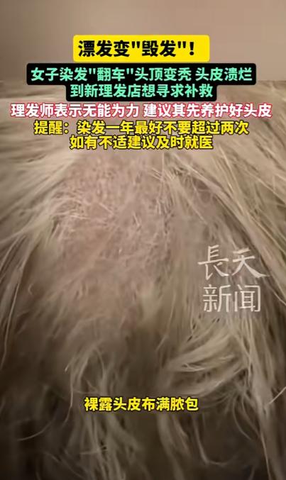 1月20日，上海，一女子去理发店染发，理发师掀开她的头发发现，她里面的头发大量脱