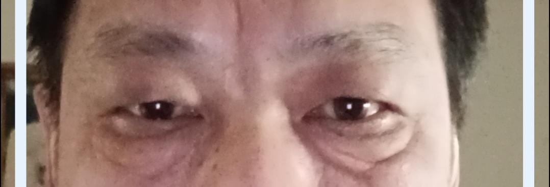 那时候看见别人黑眼圈和眼袋，觉得很奇怪，现在一样了也就不奇怪了。
