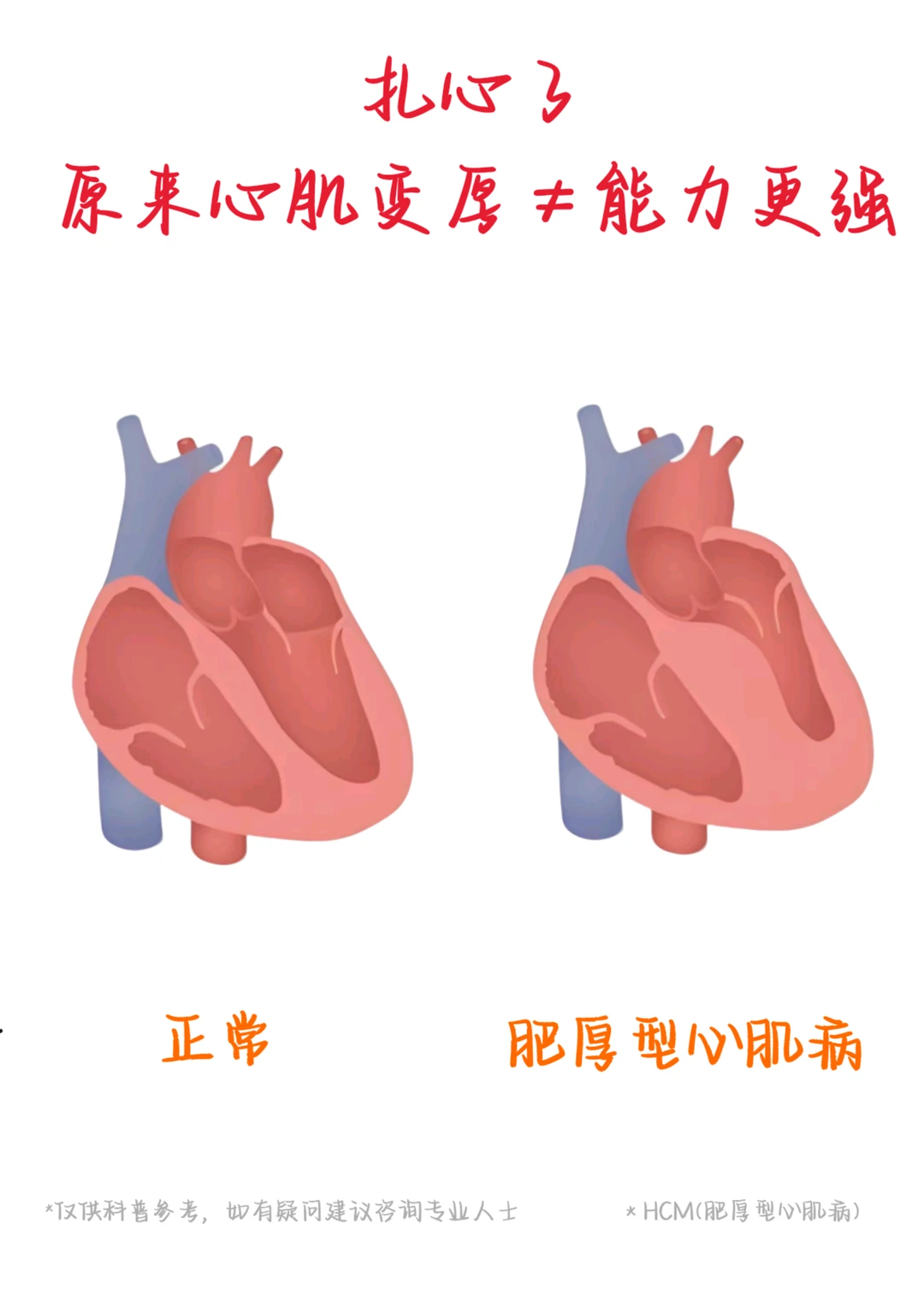扎心了，原来心肌变厚≠能力更强