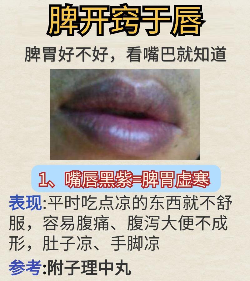 脾开窍于唇，脾胃好不好，看嘴唇就知道。
