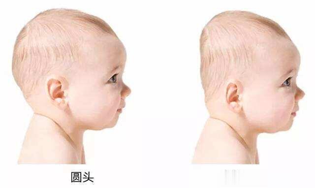 #宝贝成长守护计划# #家庭健康守护计划# 宝宝头型可调整时间段是什么时候？经常