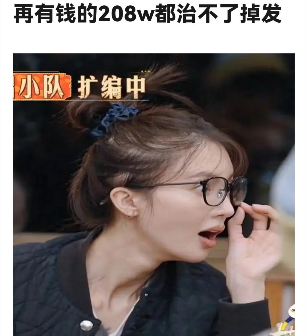 208也拯救不了自己的头发[doge] ​​​