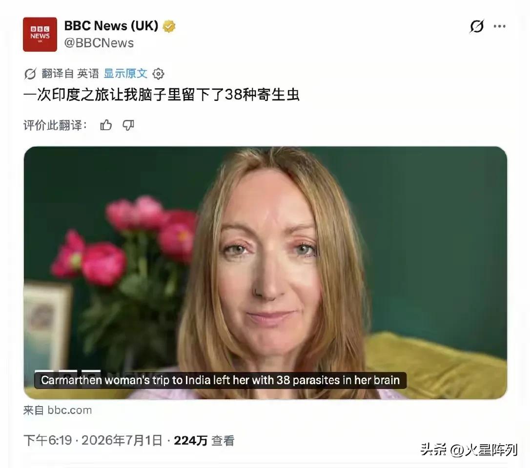 一名英国记者曾在印度旅居三个月，返程后身体出现异常不适，后续检查发现脑部竟查出感