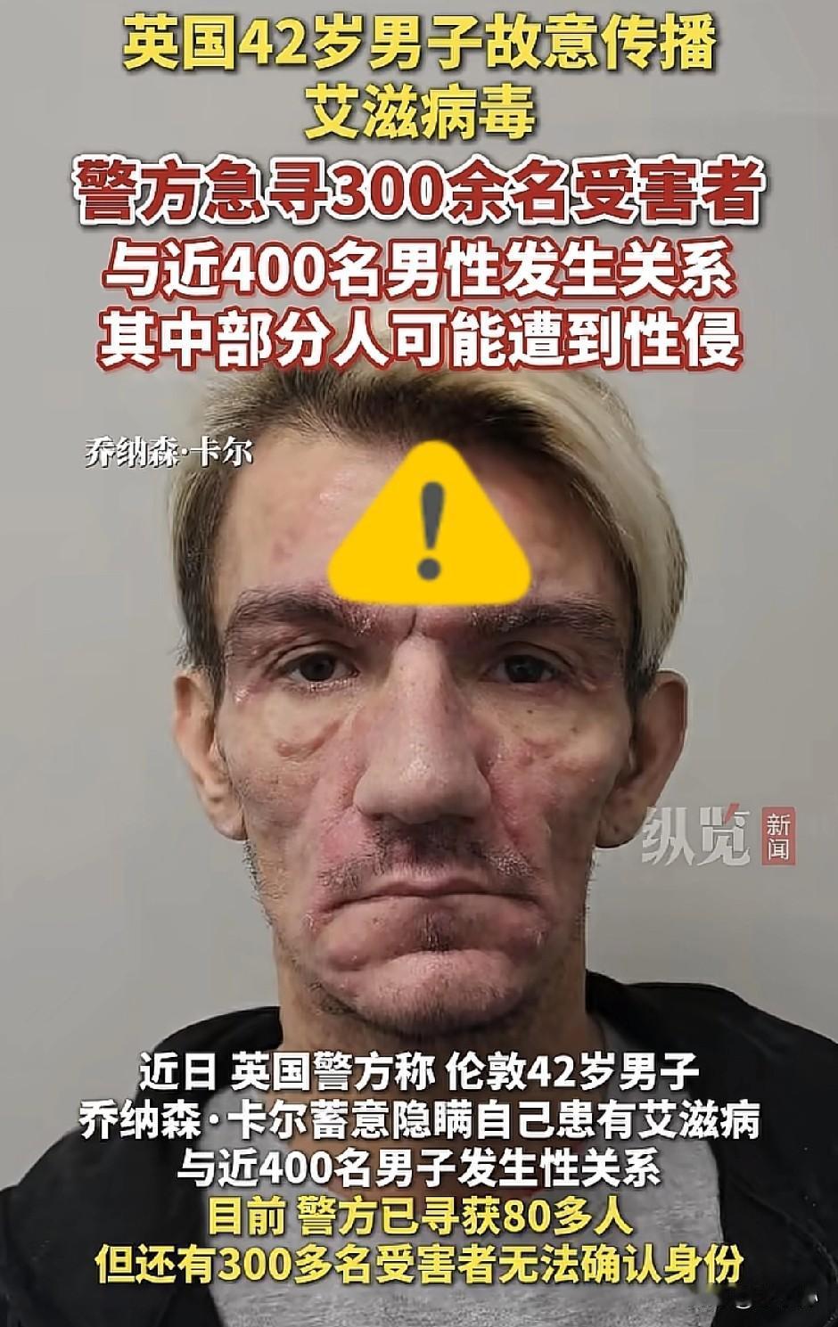 太吓人了！一男子与400多人发生关系，故意传播艾滋病毒！

看来太过“自由”，保