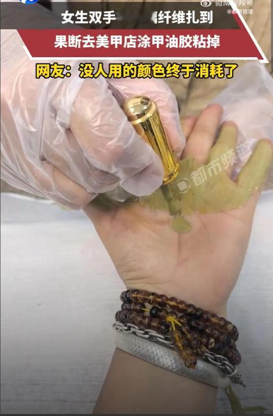 这是真聪明！浙江女生小琳双手被玻璃纤维，扎得密密麻麻，她既不自己拔，也不跑医院，