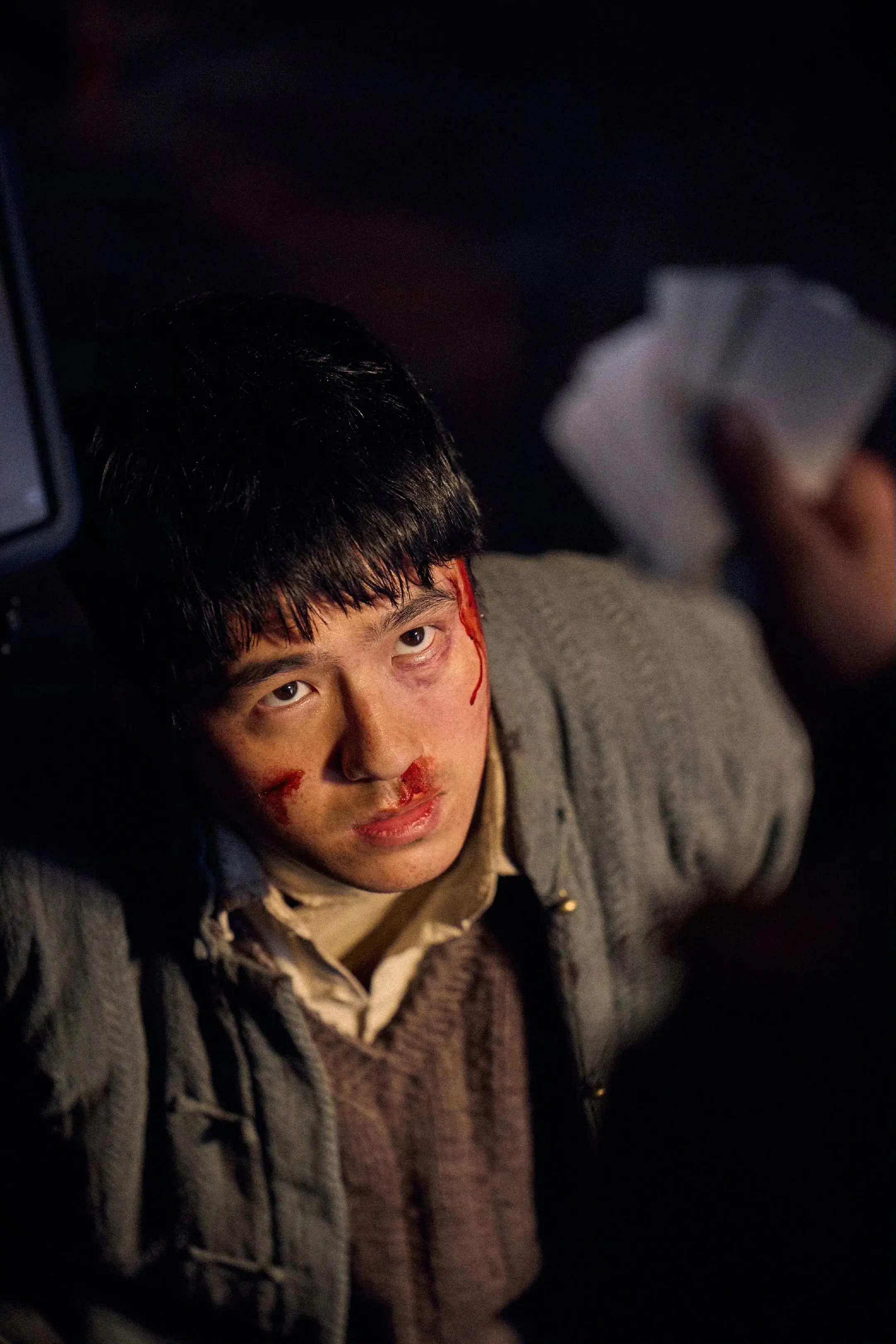 阿昌 你疼不疼。