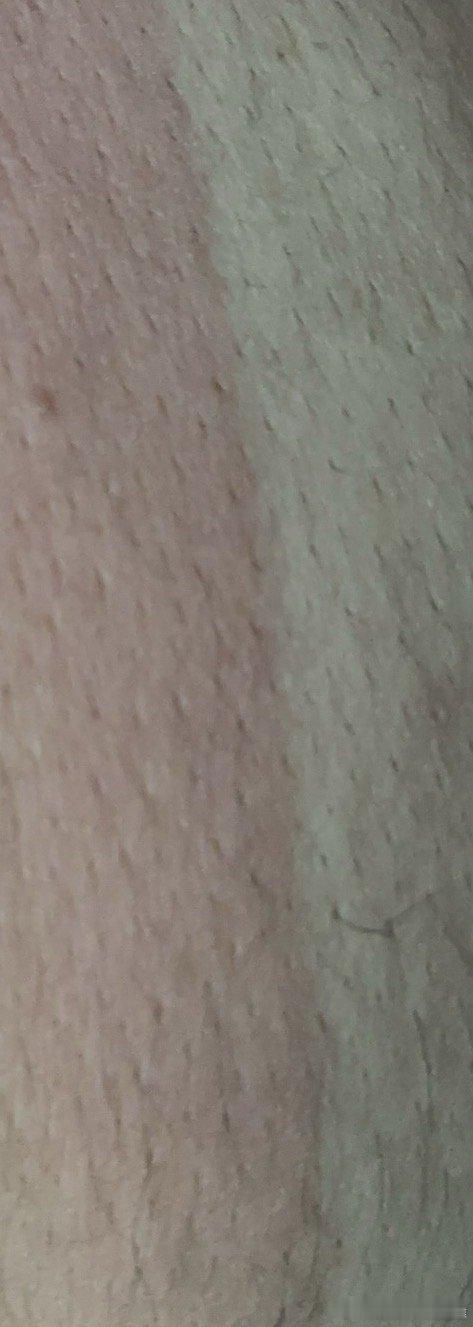 我已经发生变异了，为什么我的一半皮肤变成了红色？难道我是天龙人的血统吗？ 