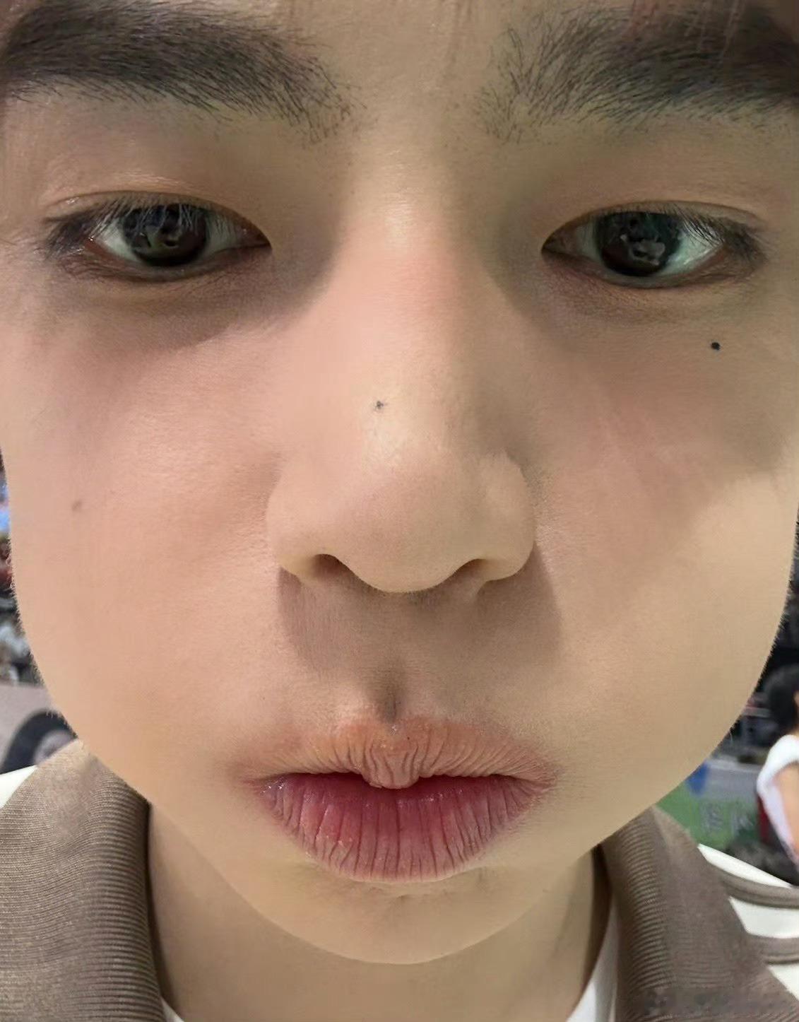 章昊怼脸照章昊公开怼脸照章昊公开怼脸照，好萌，😘 ​​​