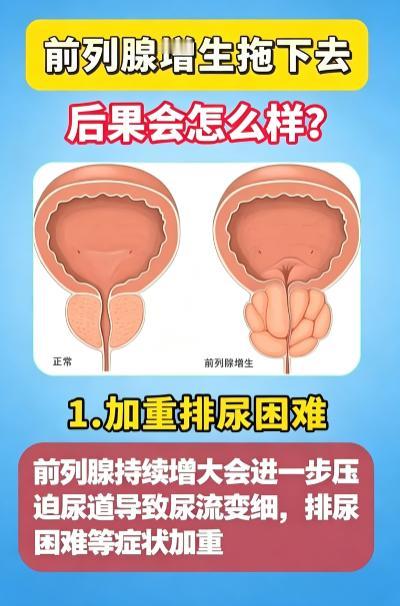 前列腺增生久拖不治，4 个不良后果要警惕
