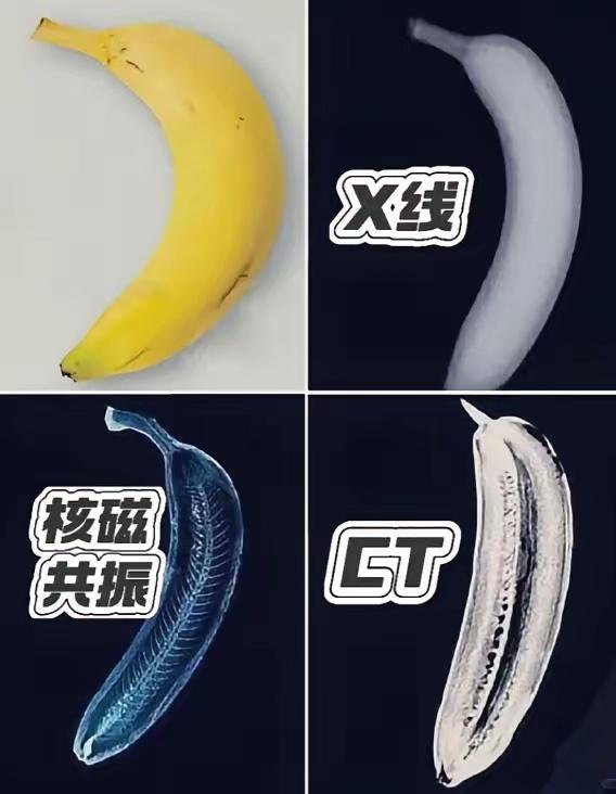 一张图教你看懂核CT、核磁共振、X光的区别！

形象点说，同一根香蕉，X光只能查