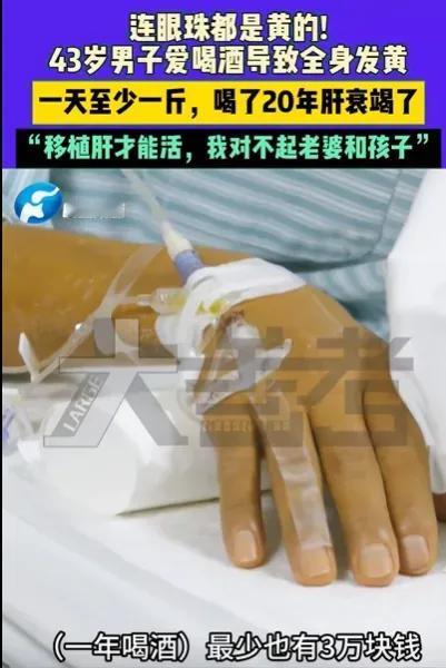 “惊心动魄！”河南郑州，一名43岁的男子嗜酒如命，每日至少豪饮一斤，年耗资至少3