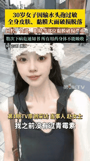 悲剧还是发生了！浙江30岁的赵女士就因为个感冒去输液，输了头孢后当晚皮肤就红肿长