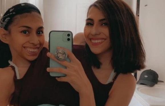 墨西哥一对连体双胞胎共享身体长达21年，近日姊姊交了男友，但碍于生理因素，每次姐