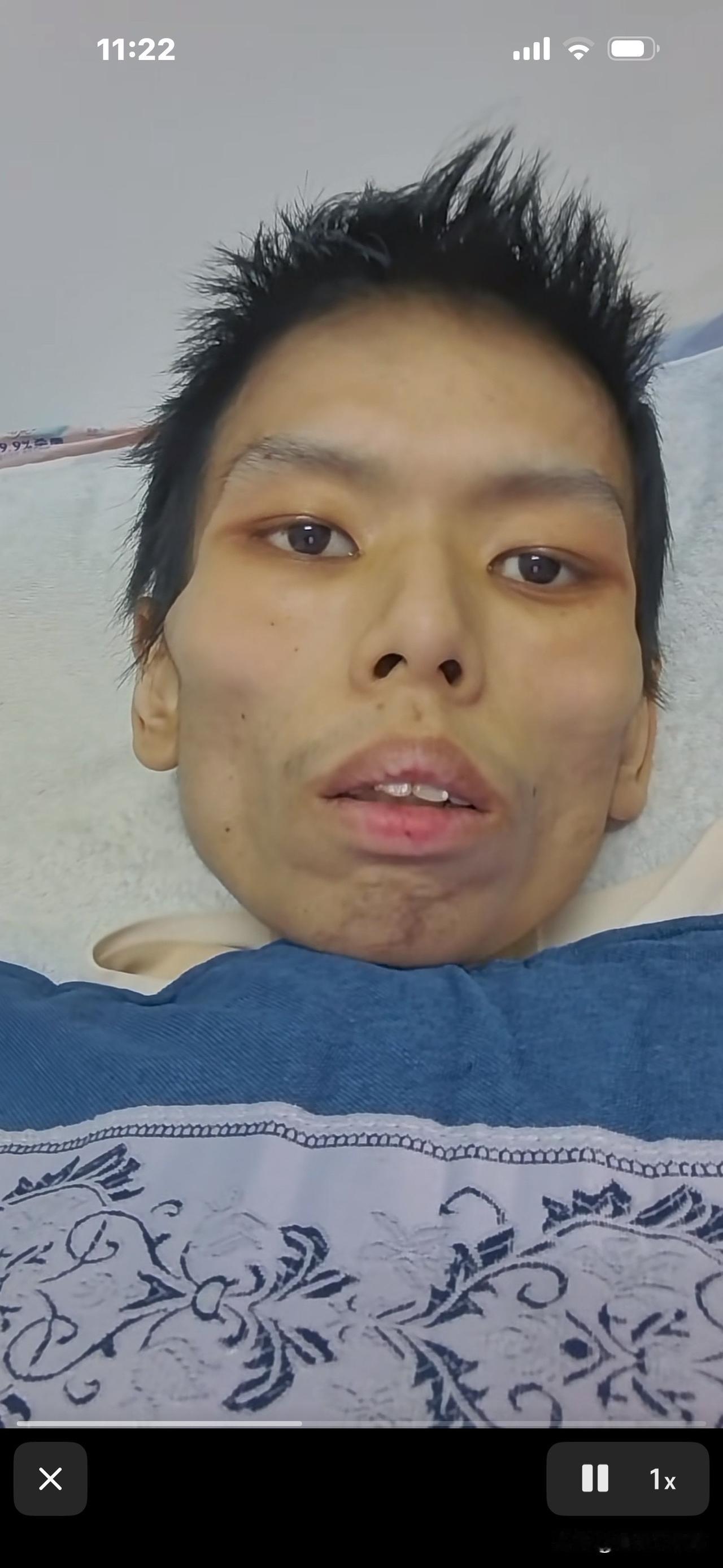 “我不行了，现在胸闷气短，有濒死感，
不管有钱没钱，我都要去医院！”
这是一位2